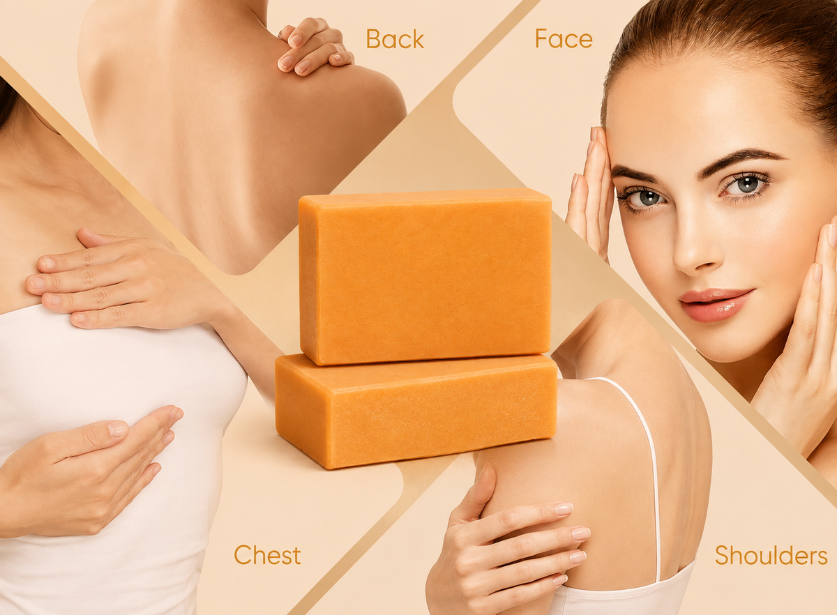 Acne Cleansing Bar